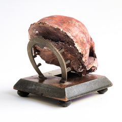 This compelling Victorian life-sized child’s skull is cast in plaster and is with its original paint finish. Mounted on a wooden stand and housed in a medical cabinet, it would have been used for phrenological and medical studies.
